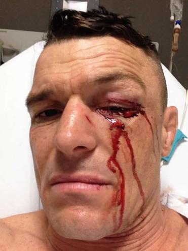 john-wayne-parr-hospital